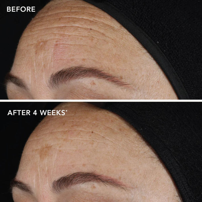 IMAGE Skincare Ageless+ Pure Liquid Retinol 0.1%