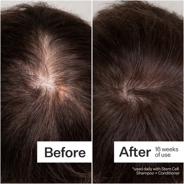 Act+Acre 3% Stem Cell Peptide Scalp Treatment 89ml