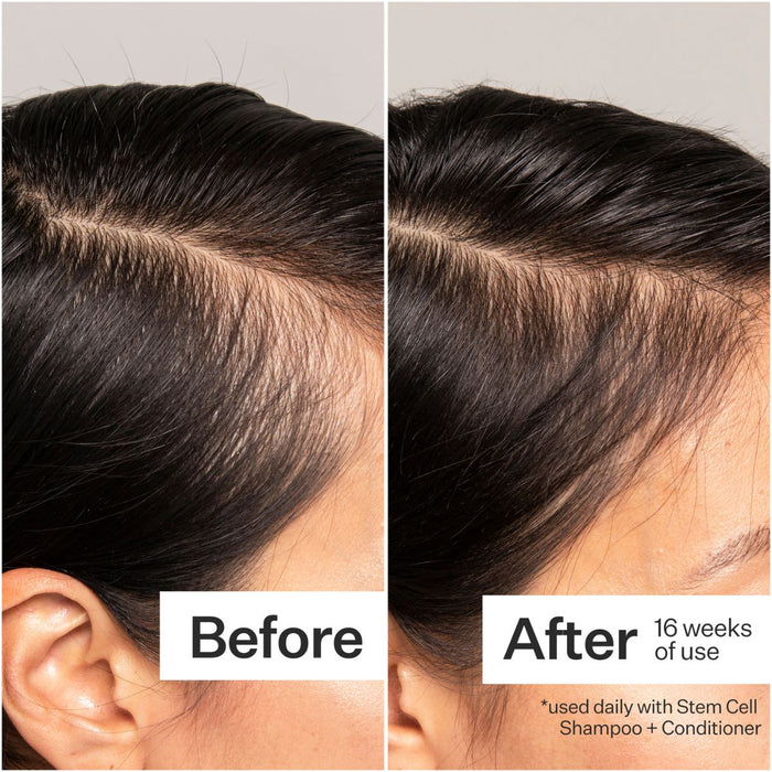 Act+Acre 3% Stem Cell Peptide Scalp Treatment 89ml