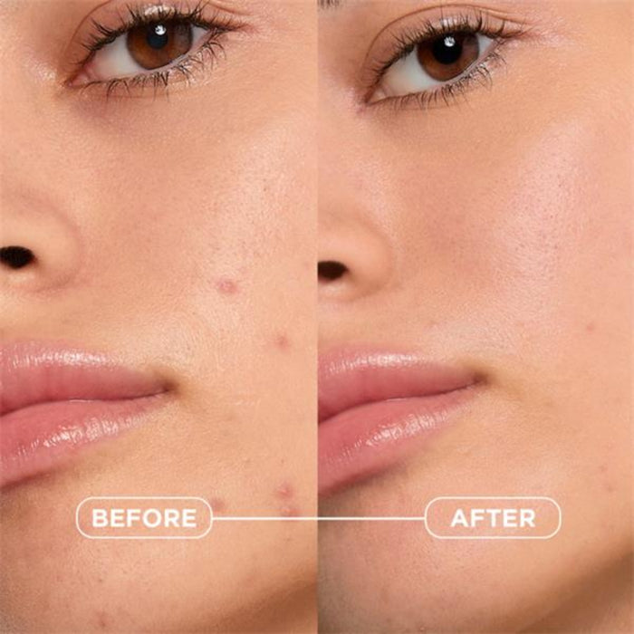 Bioderma Sébium Kerato+ Gel Cream 30ml