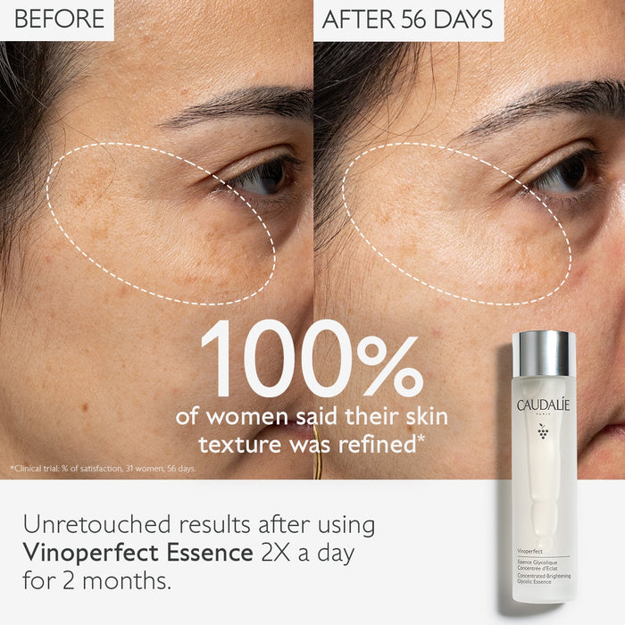 Caudalie Vinoperfect Concentrated Glycolic Essence