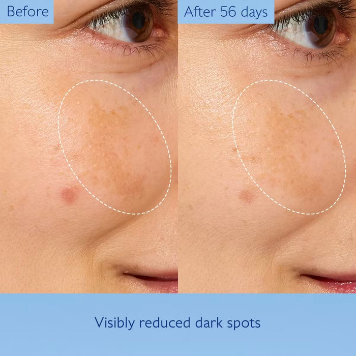 Caudalie Vinoperfect Concentrated Glycolic Essence