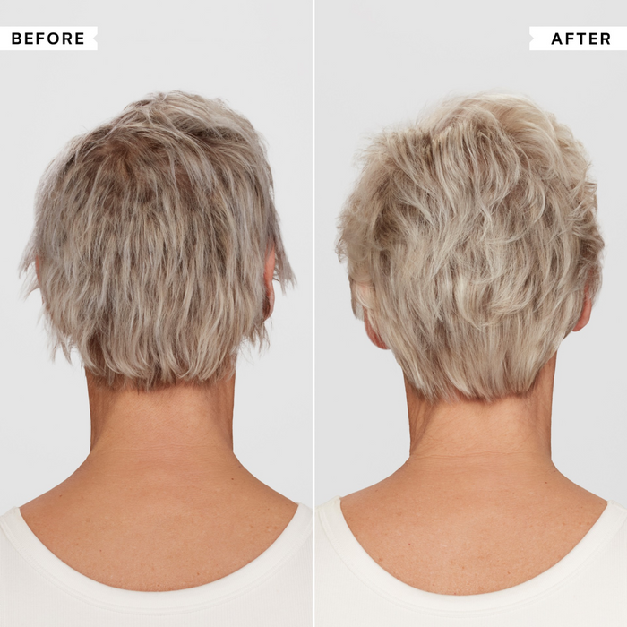 Philip Kingsley Density Scalp Essentials.