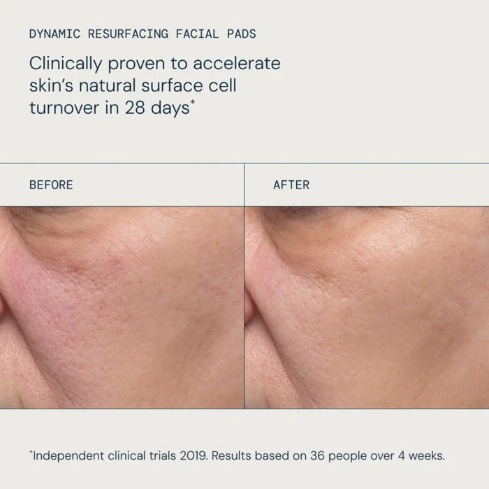 Elemis Resurface & Glow Dynamic Resurfacing Skincare Duo