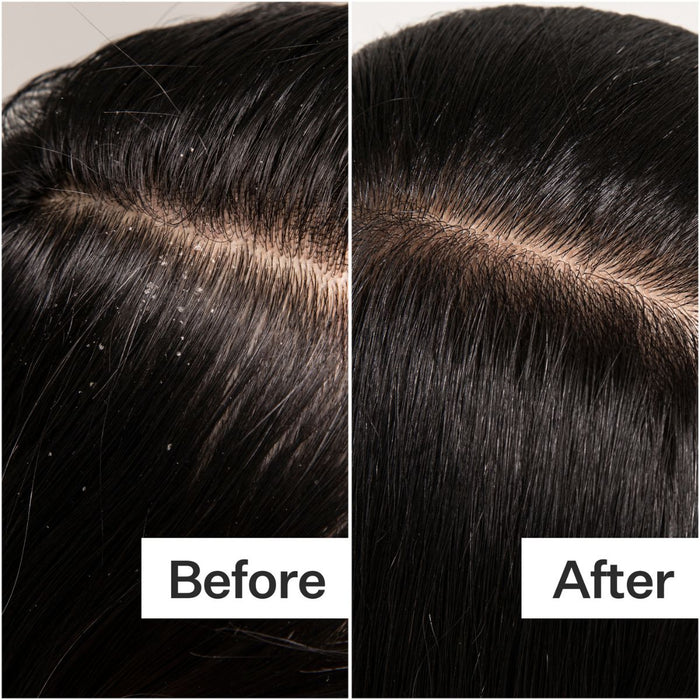 Act+Acre Cold Pressed Scalp Detox 89ml