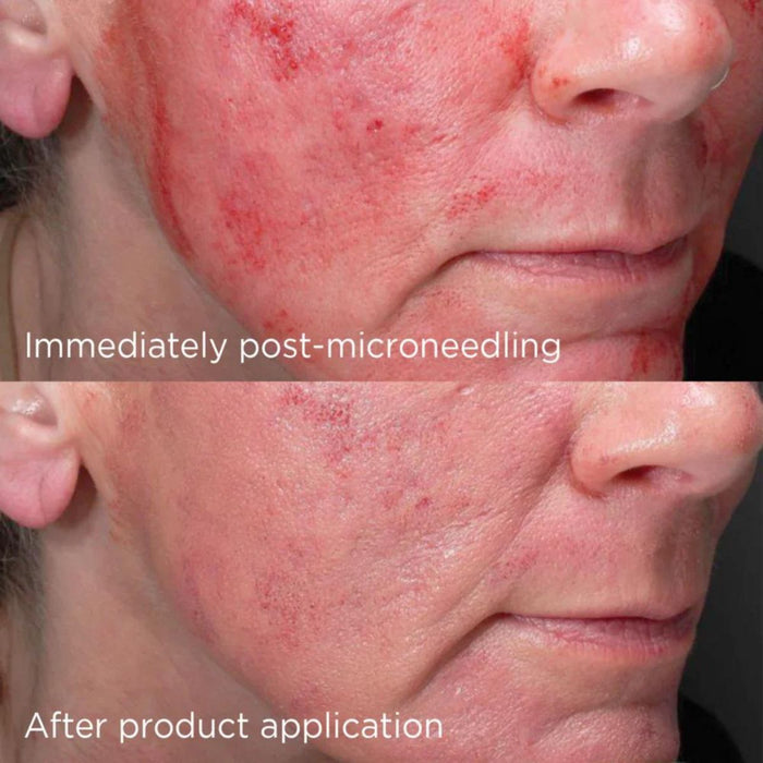 IMAGE Daily Prevention Advanced Smart Blend Mineral SPF 50
