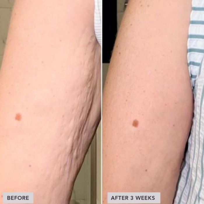 VOL.U.LIFT™ BODY Sculpt & Firm Body Complex