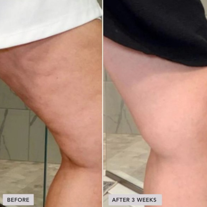 VOL.U.LIFT™ BODY Sculpt & Firm Body Complex