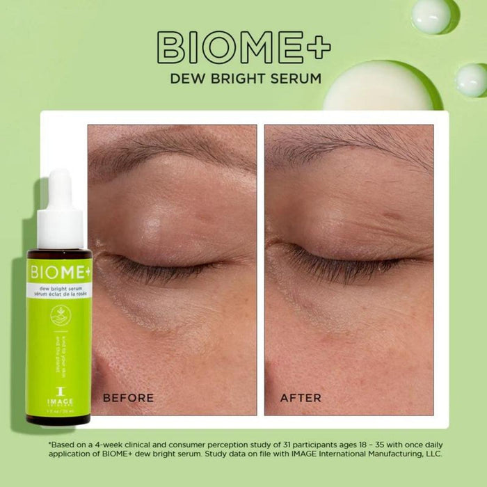IMAGE Skincare BIOME+ Dew Bright Serum 30ml