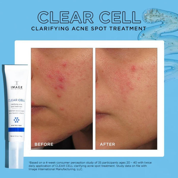 IMAGE Skincare Clear Cell Clarifying Salicylic Blemish Gel.