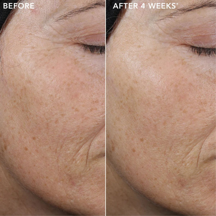 IMAGE Skincare Ageless+ Pure Liquid Retinol 0.3% Travel Size.