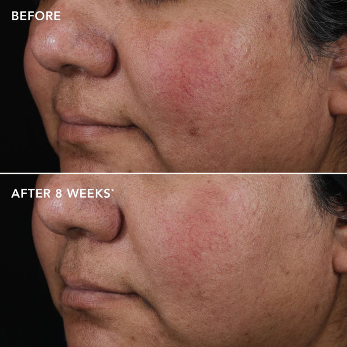 IMAGE Skincare Ageless+ Pure Liquid  Retinol 0.75% Travel Size.