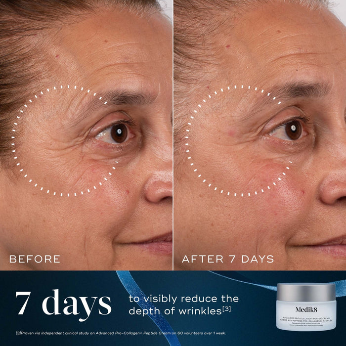 Medik8 Age-Defying Ultimate Skin Renewing Heroes