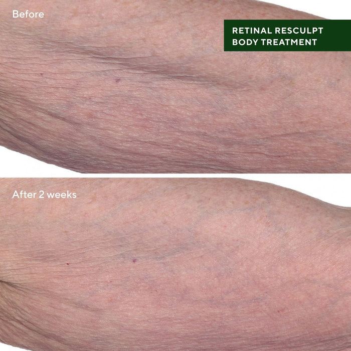 Murad Retinal ReSculpt Body Treatment