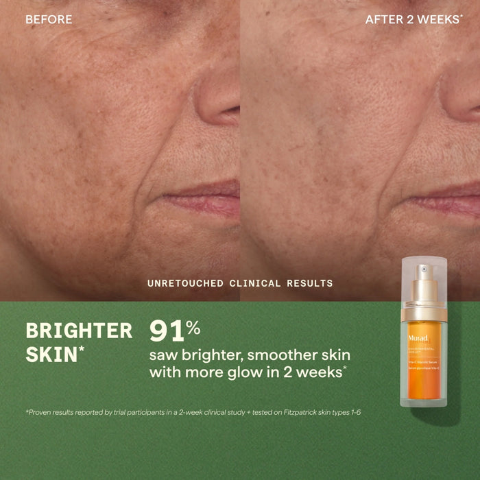 Murad Wake Bright Gift Set