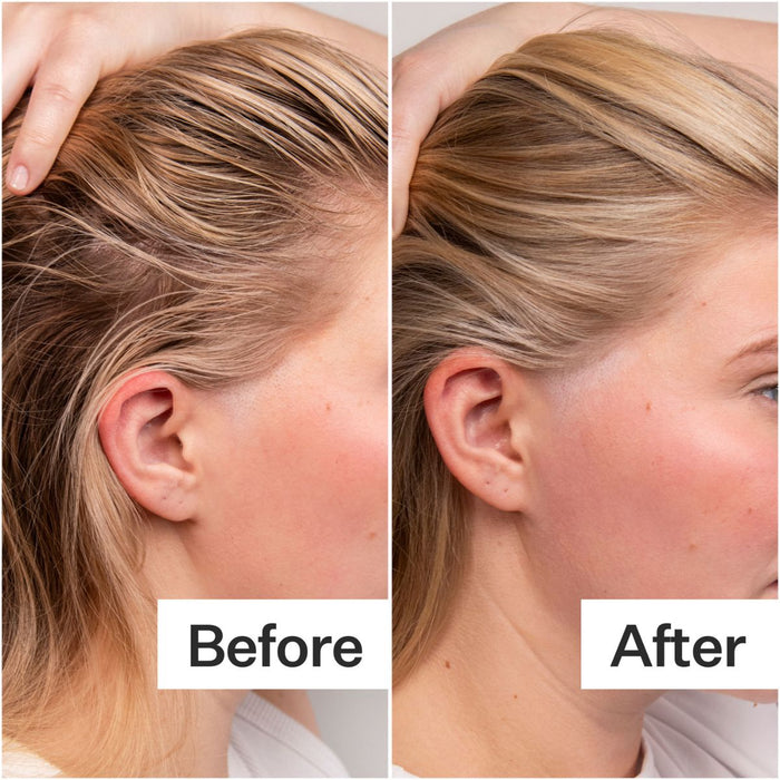 Act+Acre 4% Niacinamide Serum