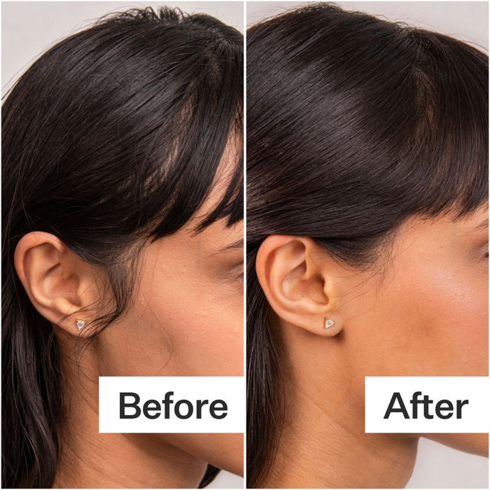 Act+Acre 4% Niacinamide Serum
