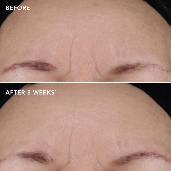 IMAGE Skincare Ageless+ Retinol Repair Crème  0.3% Retinol Complex Travel Size