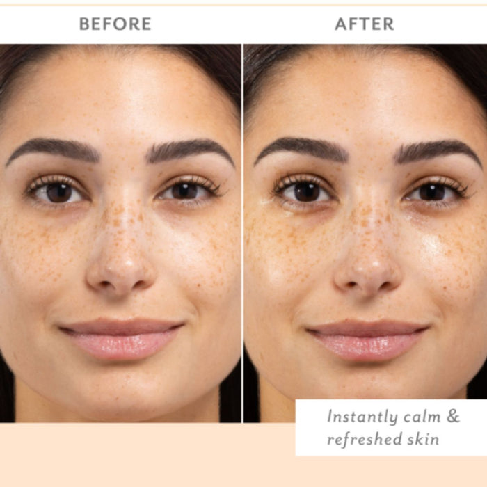 Patchology Skin Remedy Soothing Eye Gel 5 Pack