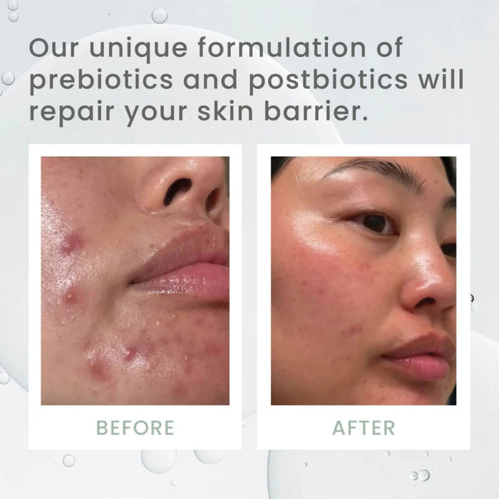 Sásta Microbiome Booster Serum 30ml