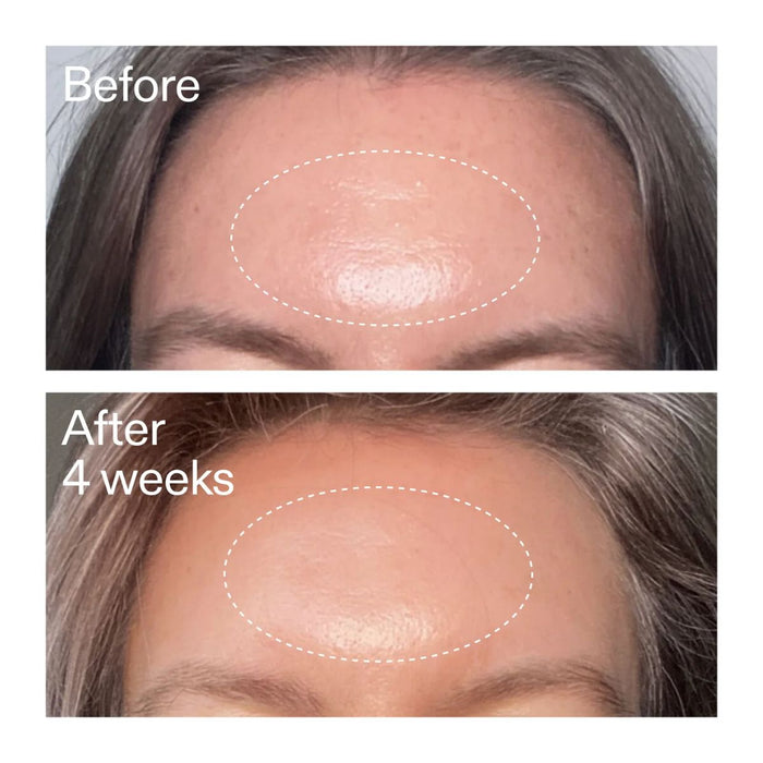 The INKEY List Advanced Retinoid Serum 15ml
