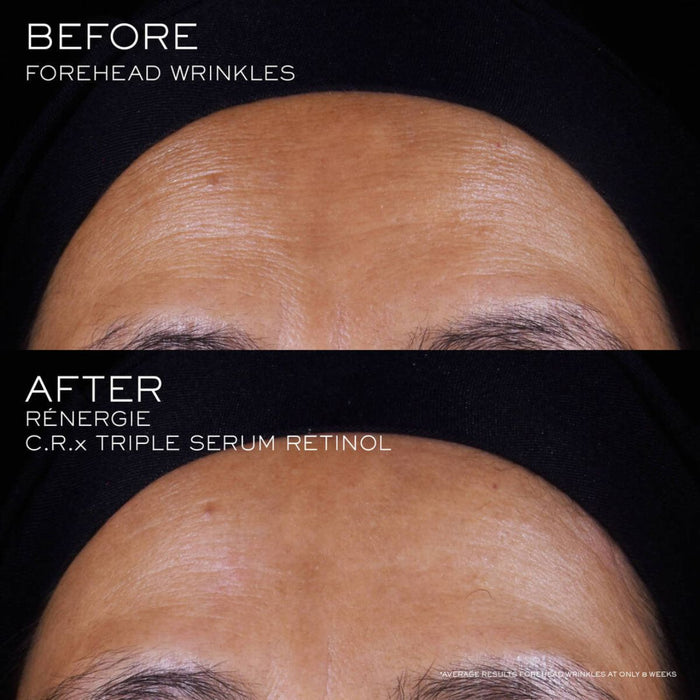 Lancôme RÉNERGIE C.R.x Triple Serum Retinol