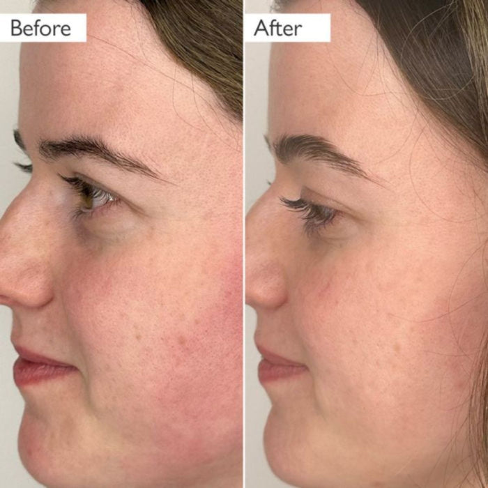 Skinician Glycolic Exfoliating Toner 100ml