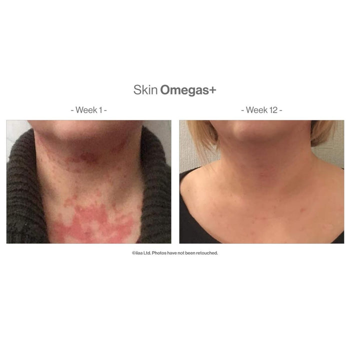 Advanced Nutrition Programme Skin Omegas+ 180 Capsules