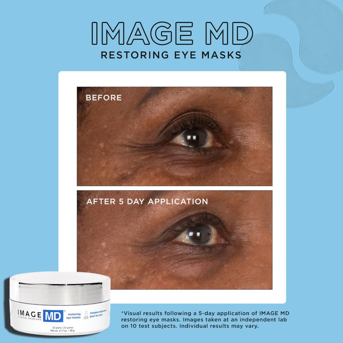 IMAGE MD Restoring Hydro-gel Eye Masks